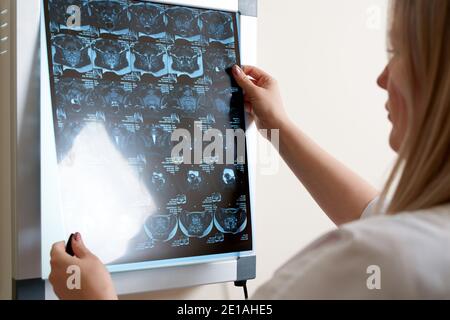 Arzt betrachtet Röntgenbild auf dem Bildschirm in der Klinik Stockfoto