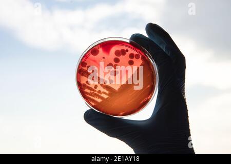 Wachsende Bakterien in Agarmedium in Mikrobiologie Labor. Making Streifen in einer Petrischale isoliert auf weißem Hintergrund. Gemischt von Bakterienkolonien in Petri d Stockfoto