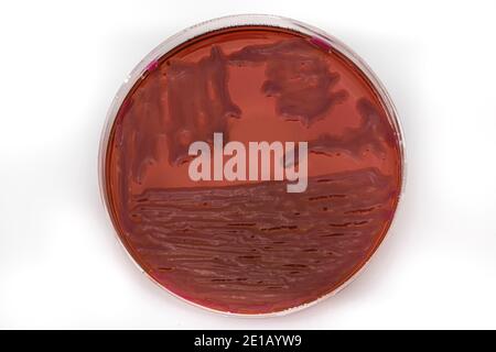 Wachsende Bakterien in Agarmedium in Mikrobiologie Labor. Making Streifen in einer Petrischale isoliert auf weißem Hintergrund. Gemischt von Bakterienkolonien in Petri d Stockfoto