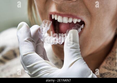 Nahaufnahme des Patienten, der eine Zahngrößenkontrolle durch den Zahnarzt erhält Stockfoto