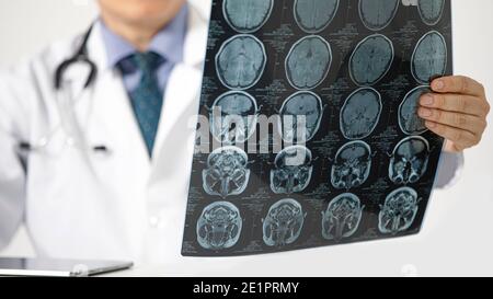 Ein Arzt, der auf einem Schreibtisch sitzt und die MRT-Untersuchung des Gehirns eines Patienten betrachtet. Selektive Fokussierung, unscharfer Hintergrund. Stockfoto