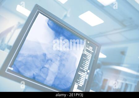 Computerüberwachung im Krankenhauskatheterlabor. Stockfoto