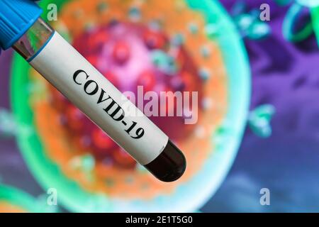 Coronavirus-Test. Nachweis von Antikörpern gegen COVID-19 in einer Blutprobe. Stockfoto