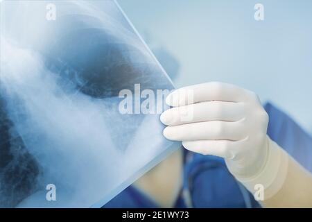 Röntgenaufnahme der Patientin in der Hand der Ärztinnen. Stockfoto