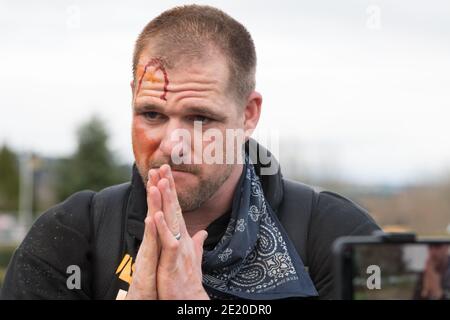 Olympia, USA. Januar 2021. Mittagsprediger eines Straßenpredigers in Seattle mit einer Verletzung seines Gesichts, der bei einem Pro Trump-Wahlprotest sprach. Der Mann erlitt Verletzungen bei einem früheren Protest Blocks entfernt. Bei beiden Protesten wurde er zurückgedrückt, weil er mit einem lauten Redner zu den Gruppen predigte. Nach dem Sturm auf den D.C. Capitol Gouverneur Jay Inslee keine Chancen, ruft die National Guard und State Troopers, um für die Möglichkeit eines groß angelegten Protest in Olympia am Tag vor dem Beginn der Legislaturperiode vorzubereiten. Quelle: James Anderson/Alamy Live News Stockfoto