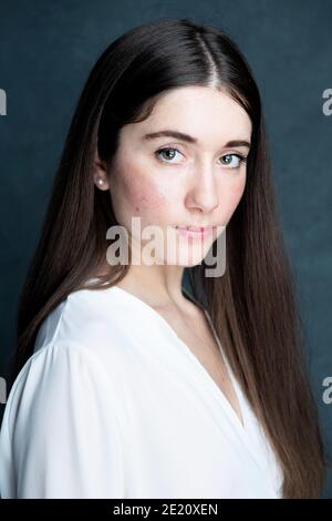 Weibchen mit Hautausschlag im Gesicht Stockfoto