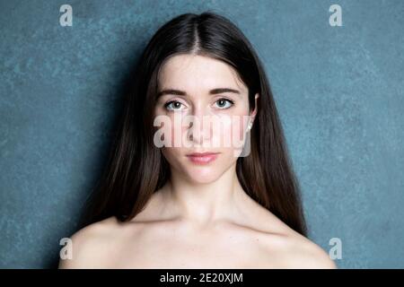 Weibchen mit Hautausschlag im Gesicht Stockfoto