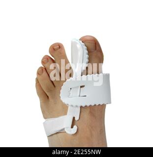 Toe Corrector Silikon Valgus Big Bunion Schiene Haarglätter Fuß. Silikon-Unterstützung für orthopädische. Hallux valgus, Bunion im Fuß auf weißem Hintergrund Stockfoto