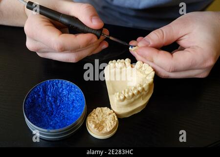 Zahntechniker Modellierung Zahnkronen mit heißem Wachs. Arbeitsplatz eines Zahntechnikers Stockfoto
