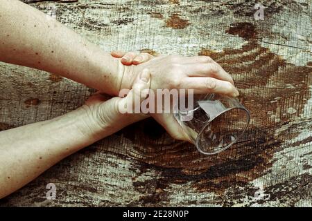 Eine Frau mit Parkinson schüttelt ihre Hände so stark, dass sie kein Glas mehr halten kann. Stark zitternde Hände einer älteren Frau Stockfoto