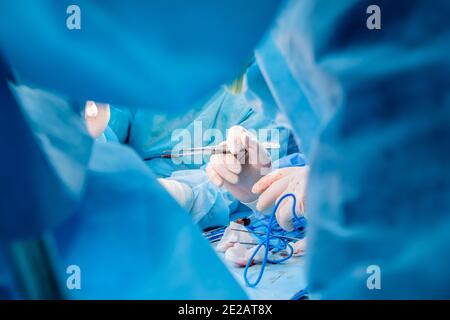 Blutige Hände des Chirurgen in sterilen Latexhandschuhen, die chirurgische Pinzetten mit Blutspuren halten. Der Vorgang der Durchführung einer chirurgischen Operation. Stockfoto