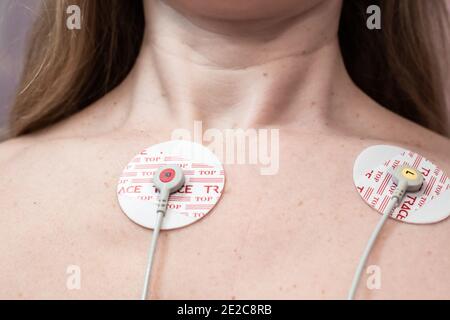 Kogalym, Russia-04.27.2020:EKG-Elektroden auf der Brust einer Frau, Diagnose eines Patienten-Herzrhythmus Stockfoto