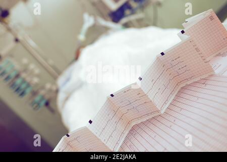 EKG-Diagramm auf dem Hintergrund des Patientenbetts. Stockfoto