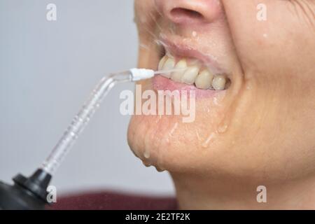 Porträt EINER jungen Frau und professionelle Oral Irrigator oder Flosser Stockfoto