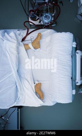 Die Füße des Patienten sind am Bett befestigt. Stockfoto