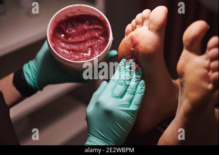 Nahaufnahme der Hände der Kosmetikerin, die eine Flasche mit Fußpeeling hält Und es auf die Füße der Frau im Schönheitssalon anwenden Stockfoto