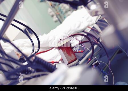 Herz-Lungen-Maschine, die auf der Intensivstation arbeitet. Stockfoto