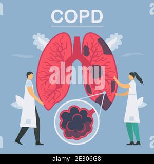 Chronisch obstruktive Lungenerkrankung oder COPD. Die Lunge hat Atemprobleme und einen schlechten Luftstrom. Vektorgrafik in flacher Ausführung. Stock Vektor
