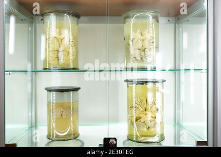 Menschliches Gehirn im Glas auf hellem Hintergrund in Formalin . Medizinische Klinik Konzept. Science Museum . Stockfoto