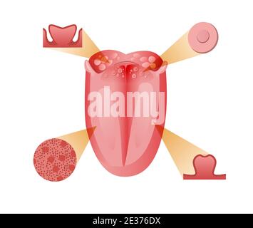 Hauptrezeptoren und Zellen Zunge. Basis Bitter Sensation Rezeptor mit schematischem sauer-rot-süßem und salzigem Geschmack. Stock Vektor