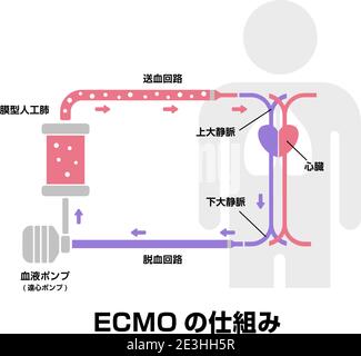 ECMO (extrakorporale Membranoxygenierung) Strukturvektordarstellung / Japanisch Stock Vektor