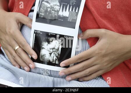 Eine schwangere Frau, die einen Ultraschallausdruck hält, der das Baby in ihrem Gebärmutterleib zeigt Stockfoto