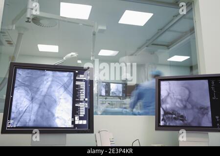 Röntgenüberwachung der Neurochirurgie am menschlichen Gehirn im Krankenhaus. Stockfoto