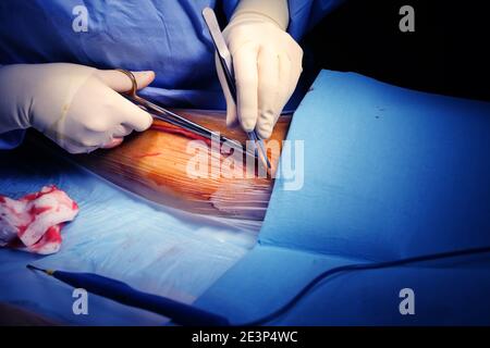 Der Chirurg beginnt im Operationssaal mit einem Hautschnitt an der Operationsstelle zu arbeiten. Stockfoto