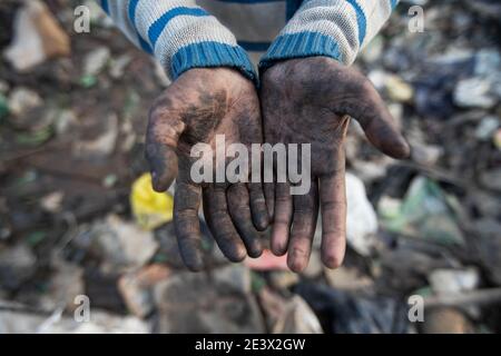 Neu Delhi, Indien. Januar 2021. Der zehnjährige Shekh Zahid zeigt seine Hände schmutzig vom Müllsammeln auf der Müllhalde in Bhalswa. Der Viertklässler aus Malda in Westbengalen, dessen Vater als Rikscha-Fahrer arbeitet, begann während der Aussperrung im Oktober 2020 zu arbeiten, als Schulen geschlossen wurden. Seine Familie schickte ihn nach Delhi, um bei einem Onkel zu bleiben, der bereits als RAG Picker arbeitete. Shek verdient 150 Rupien pro Tag, um recycelbares Material aus der Mülldeponie zu sammeln. (To dpa 'Shame der Welt: Armut zwingt Millionen von Kindern zur Arbeit') Quelle: Vijay Pandey/dpa/Alamy Live News Stockfoto