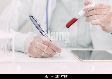 Nicht erkennbarer Arzt trägt Gummihandschuhe und weißen Mantel mit Blutprobe in modernen Labor arbeiten. Die Hand des Arztes hält Blut in einem Reagenzglas. Stockfoto