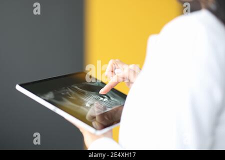 Weiblicher Finger auf Tablette mit humanem Kiefer Stockfoto
