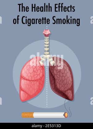 Poster über die gesundheitlichen Auswirkungen des Zigarettenrauchens Illustration Stock Vektor