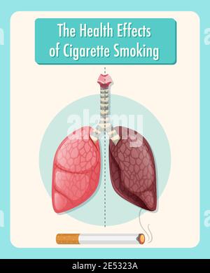 Poster über die gesundheitlichen Auswirkungen des Zigarettenrauchens Illustration Stock Vektor