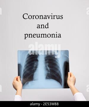 Der Arzt hält eine Röntgenaufnahme eines Patienten mit einer Coronavirus-Pneumonie. Komplikationen der Viruserkrankung COVID-19 Stockfoto