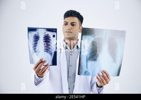 Seriöse junge indische Arzt Vergleich zwei Brust Röntgenaufnahmen des Patienten, isoliert auf weiß Stockfoto