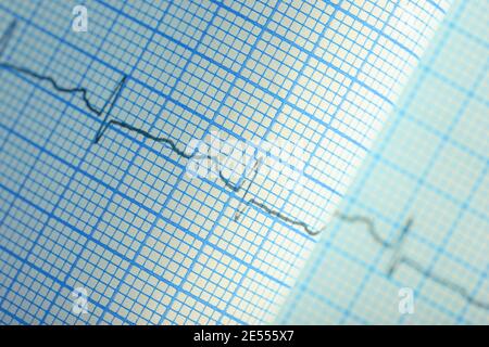 Kurvenlinie im Plottierpapier. Stockfoto