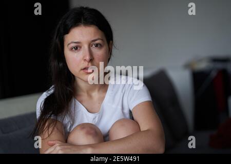 Porträt der geschlagenen Frau mit Tränen des Gesichts und Prellung auf dem Knie sitzen auf dem Sofa. Stockfoto