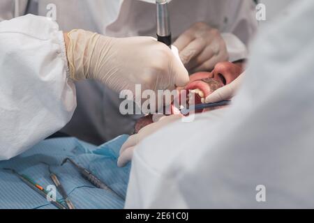 Zahnpatient, der seine Zähne vom Hygienisten reinigen und polieren lassen kann. Zahngesundheit Konzept Stockfoto