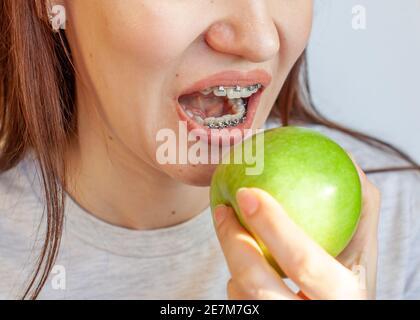 Ein Mädchen mit Zahnspangen will einen grünen Apfel beißen. Nahaufnahmen von Zähnen und Lippen. Glatte Zähne von Zahnspangen. Foto auf einem hellen soliden Rücken Stockfoto