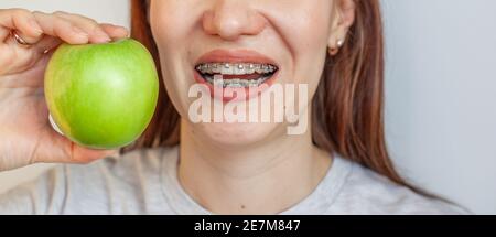 Ein Mädchen mit Zahnspangen will einen grünen Apfel beißen. Nahaufnahmen von Zähnen und Lippen. Glatte Zähne von Zahnspangen. Foto auf einem hellen soliden Rücken Stockfoto
