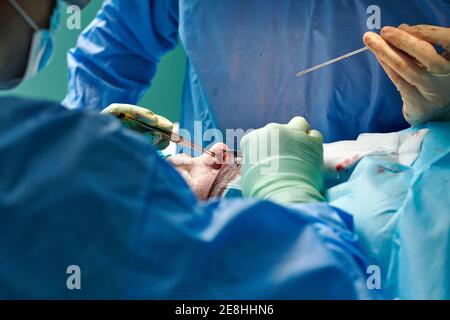 Schneiden Sie unkenntlich plastische Chirurgen in Kleidern und Handschuhen mit einer Pinzette Während der Durchführung Rhinoplastik Operation in der zeitgenössischen Klinik Stockfoto