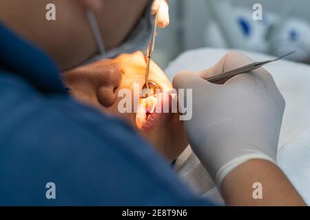 Rückansicht des Zahnarztes mit der Zahnsonde und dem Scaler Während der zahnmedizinischen Check-up Stockfoto