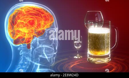 cg Medizin 3D Illustration, Mensch von Wein und Getränken betroffen Stockfoto