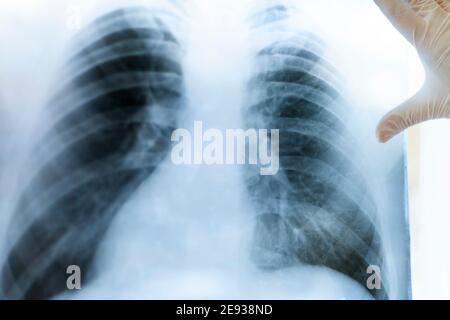 Eine Pneumologin hält eine Lungenscan in ihren Händen. Stockfoto