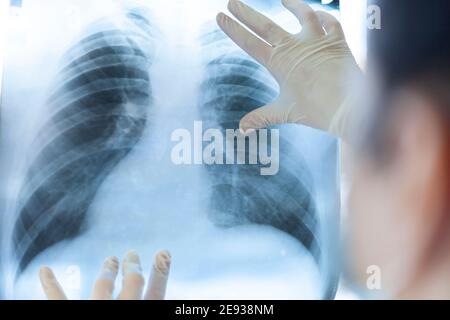 Eine Pneumologin hält eine Lungenscan in ihren Händen. Stockfoto