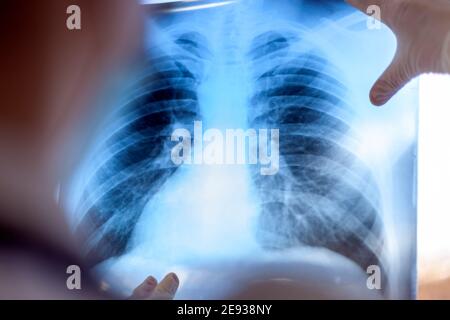 Eine Pneumologin hält eine Lungenscan in ihren Händen. Stockfoto