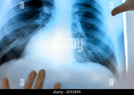 Eine Pneumologin hält eine Lungenscan in ihren Händen. Stockfoto