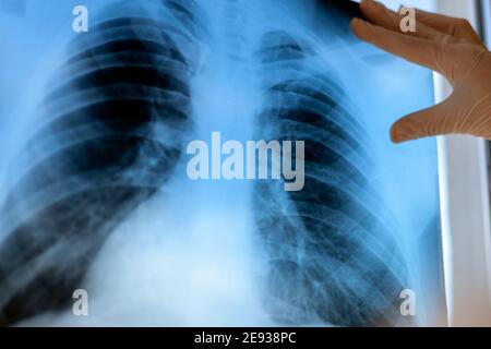 Eine Pneumologin hält eine Lungenscan in ihren Händen. Stockfoto