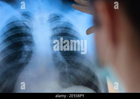 Eine Pneumologin hält eine Lungenscan in ihren Händen. Stockfoto