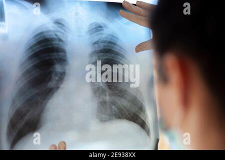 Eine Pneumologin hält eine Lungenscan in ihren Händen. Stockfoto